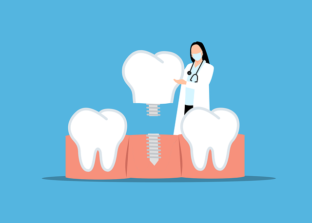 illustration of an implant